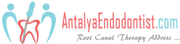 Antalya Endodonti-Kanal Tedavisi